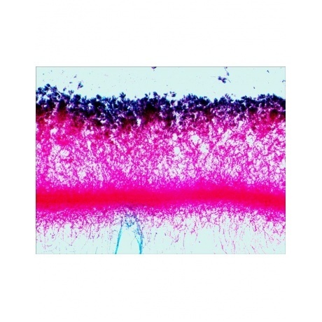 Набор готовых микропрепаратов Levenhuk N38 NG - фото 5