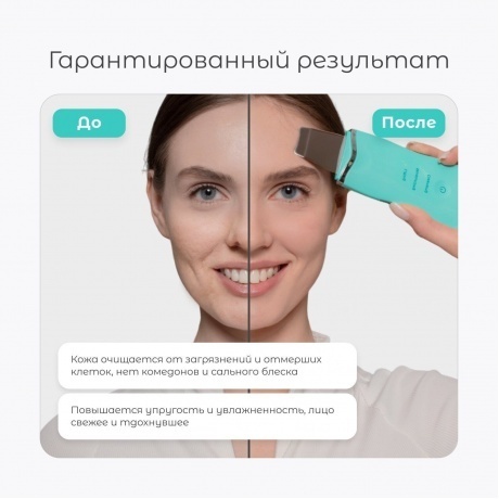 Аппарат для ультразвуковой чистки и лифтинга Gezatone Bio Sonic 770S, зеленый - фото 13