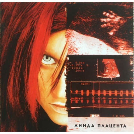 Линда - Плацента (4627135120203) виниловая пластинка