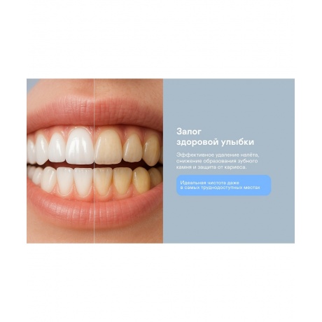 Щетка зубная электрическая GARLYN Smile Activecare white - фото 6